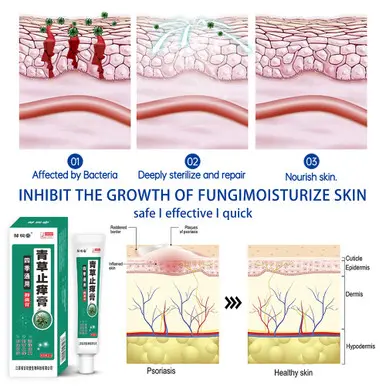 Herbal Antibacterial Cream Psoriasis Cream Itching Relief Eczema Rash Urticaria Scaling Treatment