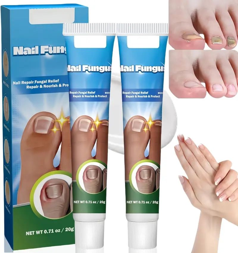 Nail Fungus, anti fungal Treatment Cream - 20g