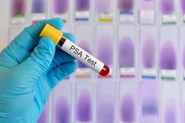 Prostate Profile (3 health indicators)- In Store/Home